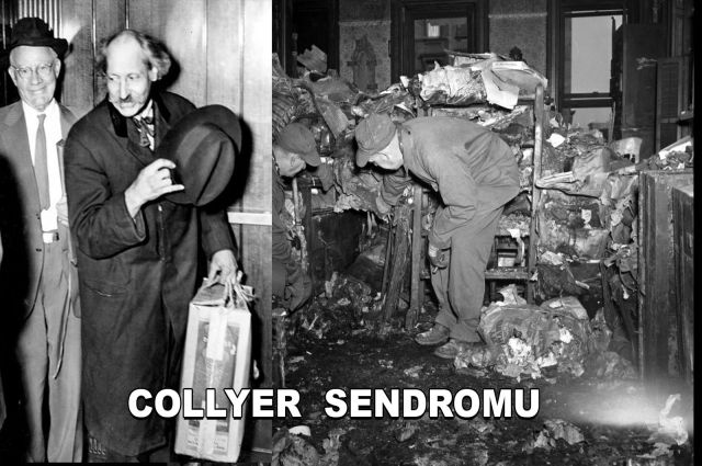 COLLYER SENDROMU
